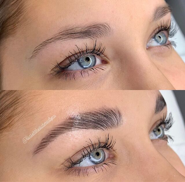 Brows Lashes Before and After Photo by Liv Aesthetics Medical Spa in New Fairfield CT