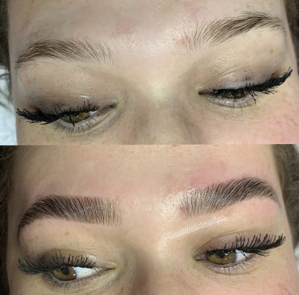 Brow Lamination before and after photo by Liv Aesthetics Medical Spa in New Fairfield, CT